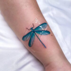 Oparzenia słoneczne